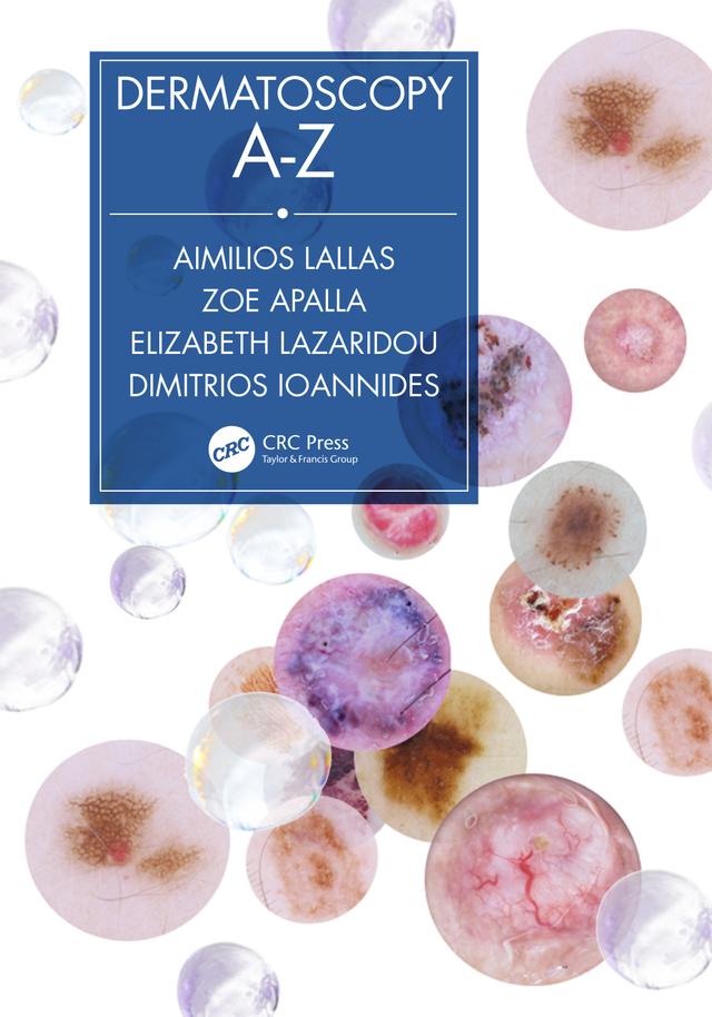 Dermatoscopy A-Z by Aimilios Lallas, Dimitrios Ioannides, Elizabeth Lazaridou, Zoe Apalla