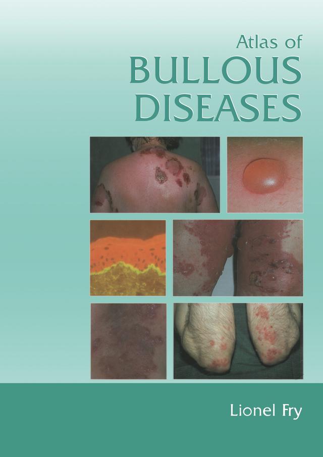 Atlas of Bullous Diseases by Lionel Fry