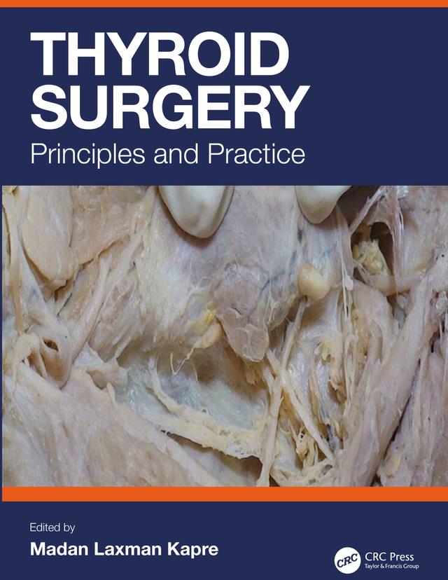 Thyroid Surgery by Madan Kapre