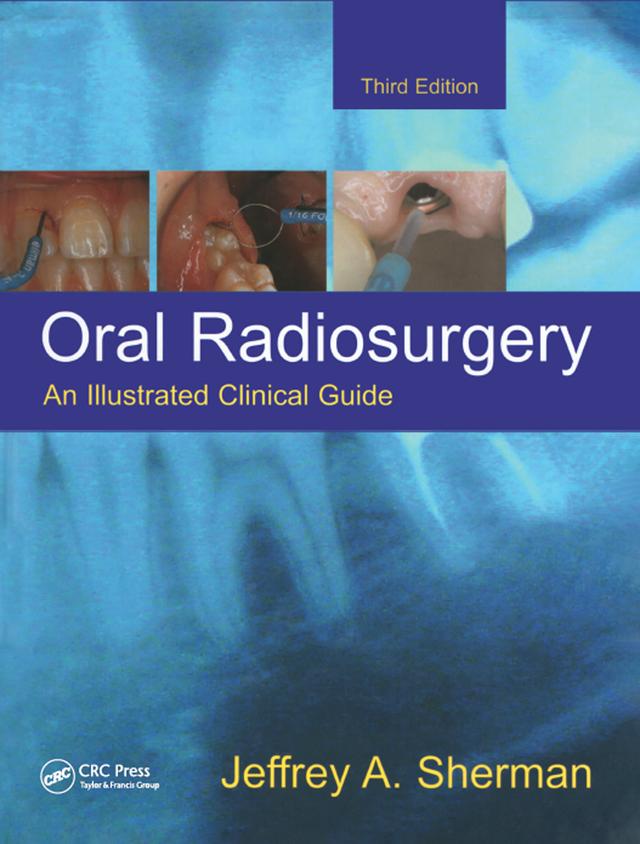 Oral Radiosurgery by Jeffrey A. Sherman