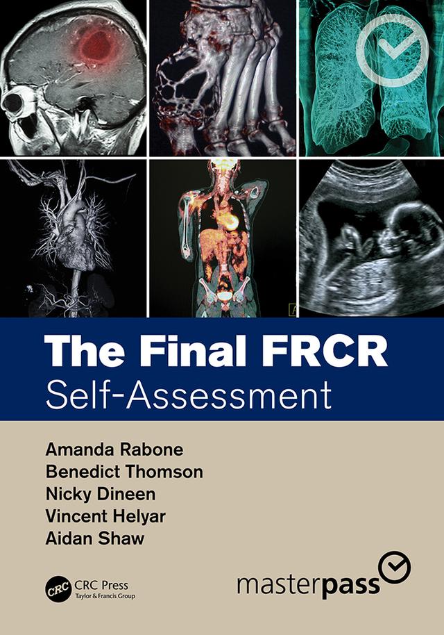 The Final FRCR by Aidan Shaw, Amanda Rabone, Benedict Thomson, Nicky Dineen, Vincent Helyar