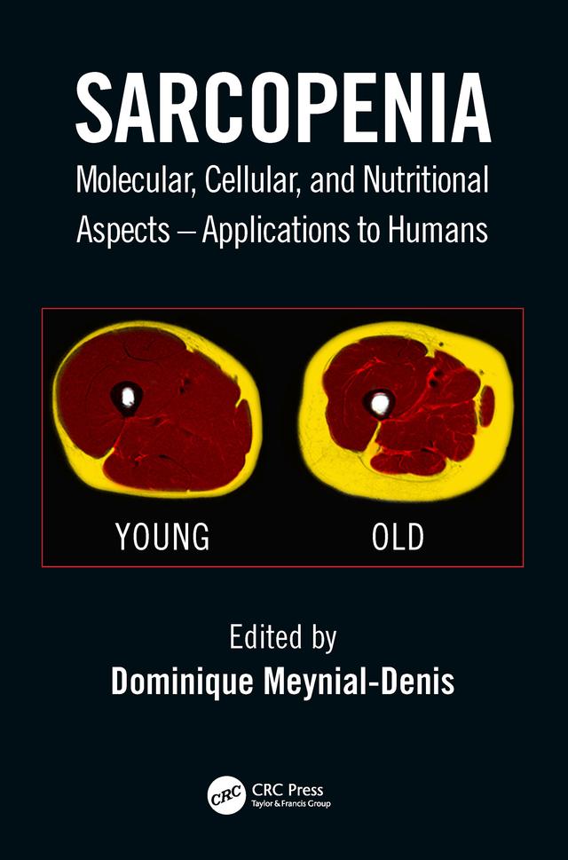 Sarcopenia by Dominique Meynial-Denis