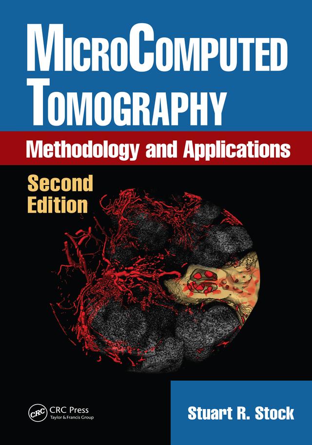 MicroComputed Tomography by Stuart R. Stock