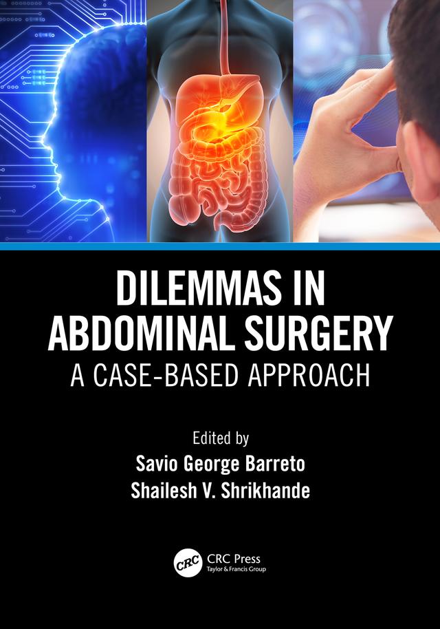 Dilemmas in Abdominal Surgery by Savio George Alberto da Piedade Barreto, Shailesh Vinayak Shrikhande