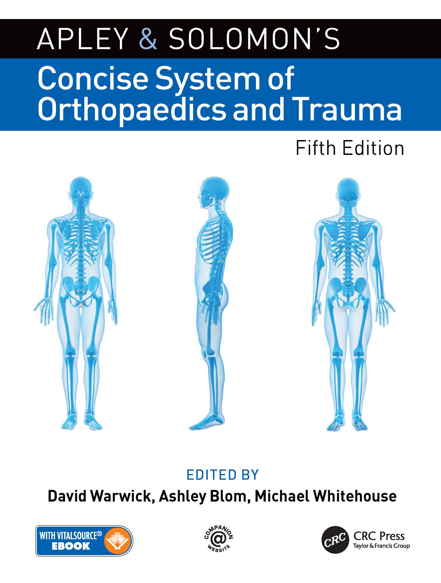 Apley and Solomon’s Concise System of Orthopaedics and Trauma