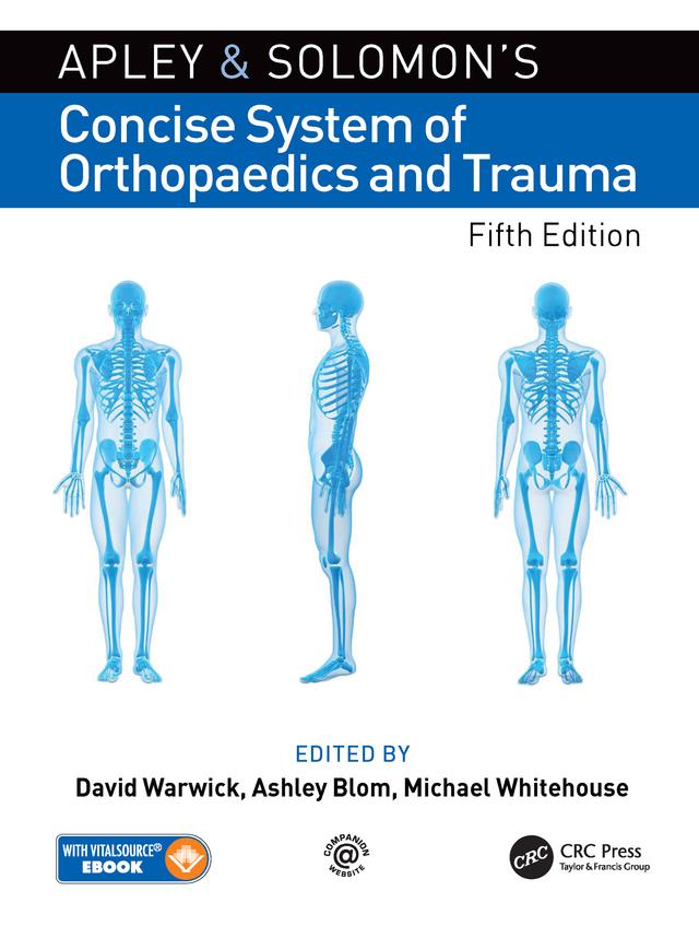 Apley and Solomon’s Concise System of Orthopaedics and Trauma by Ashley Blom, David Warwick, Michael Whitehouse