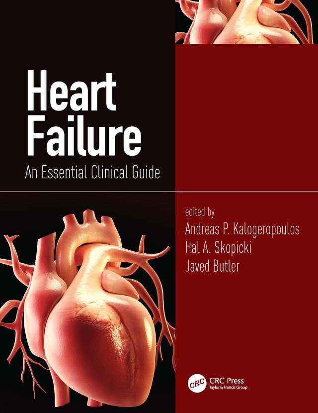Heart Failure by Andreas P. Kalogeropoulos, Hal A. Skopicki, Javed Butler