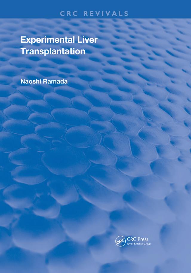 Experimental Liver Transplantation by Naoshi Kamada