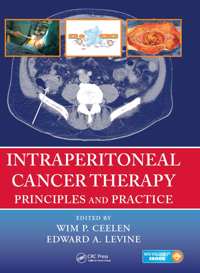 Intraperitoneal Cancer Therapy by Edward Levine, Wim P. Ceelen
