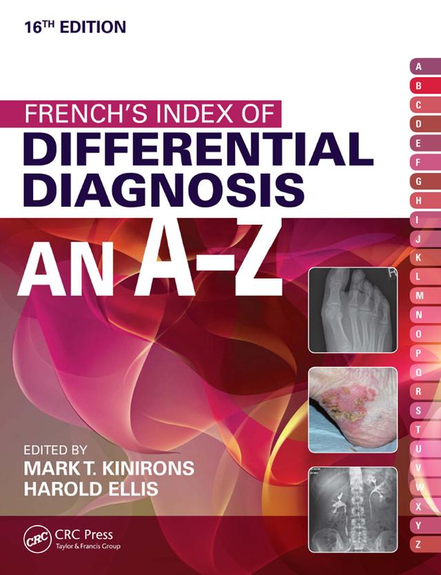French's Index of Differential Diagnosis An A-Z 1 by Harold Ellis, Mark T. Kinirons