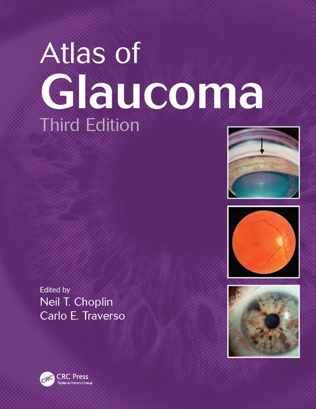 Atlas of Glaucoma by Carlo E. Traverso, Neil T. Choplin