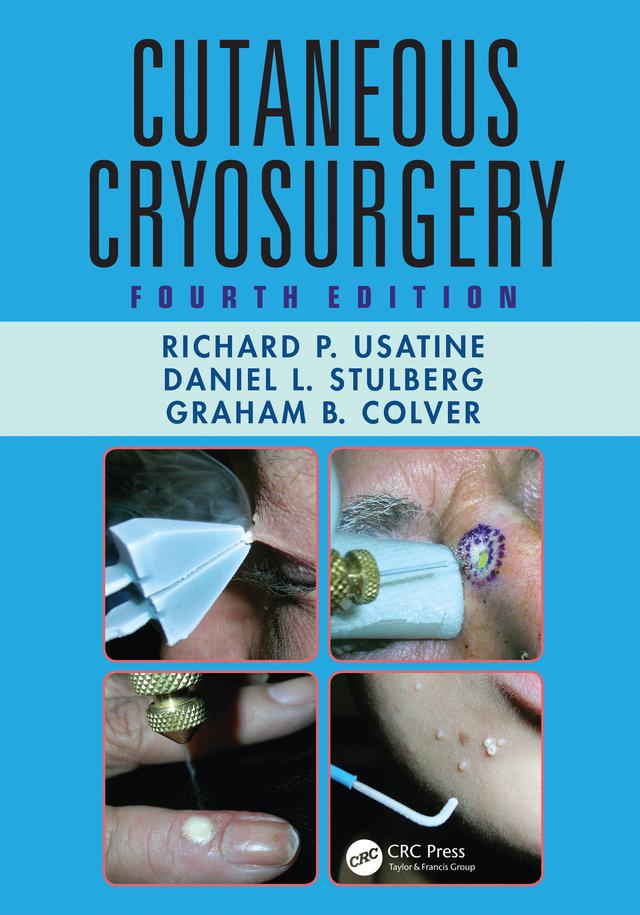 Cutaneous Cryosurgery by Daniel L. Stulberg, Graham B. Colver, Richard P. Usatine