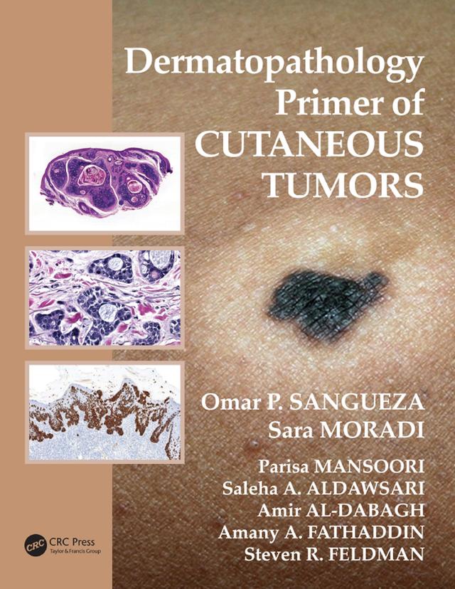 Dermatopathology Primer of Cutaneous Tumors by Amany Abdulgader Fathaddin, Amir Al-Dabagh, Omar P. Sangueza, Parisa Mansoori, Saleha Aldawsari, Sara Moradi, Steven R. Feldman