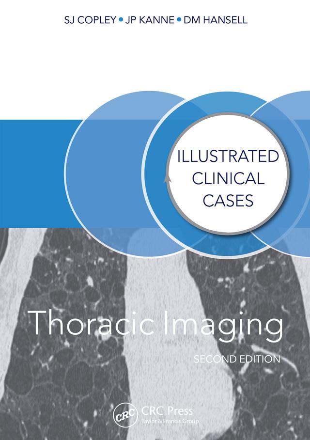 Thoracic Imaging by David Hansell, Jeffrey Kanne, Sue Copley