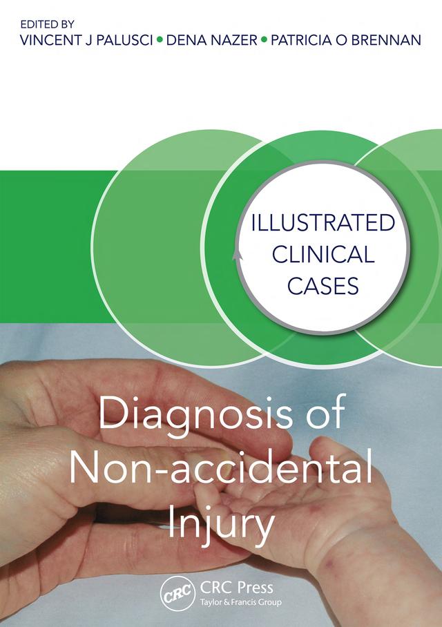 Diagnosis of Non-accidental Injury by Dena Nazer, Patricia Brennan, Vincent J. Palusci