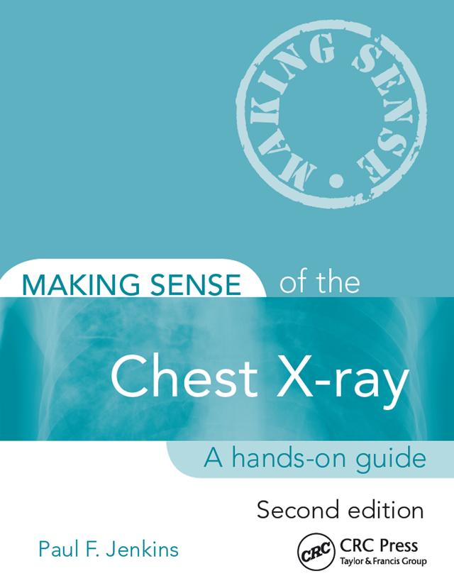 Making Sense of the Chest X-ray by Paul Jenkins