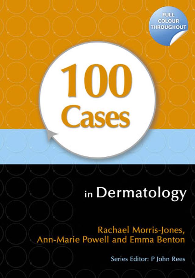 100 Cases in Dermatology by Ann-Marie Powell, Emma Benton, Rachael Morris-Jones