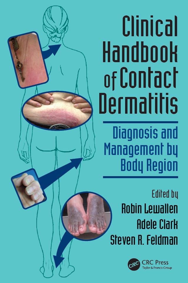 Clinical Handbook of Contact Dermatitis by Adele Clark, Robin Lewallen, Steven R. Feldman