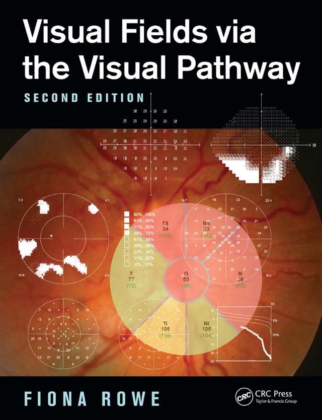 Visual Fields via the Visual Pathway by Fiona Rowe