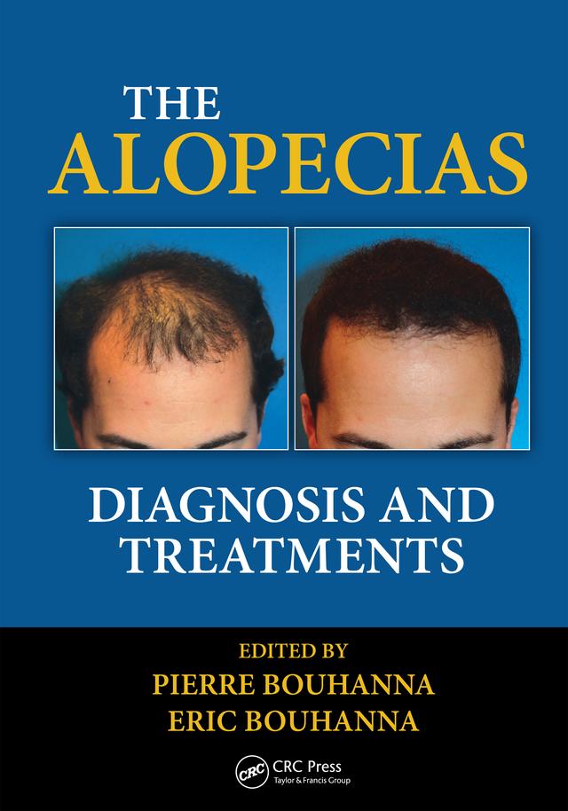 The Alopecias by Eric Bouhanna, Pierre Bouhanna