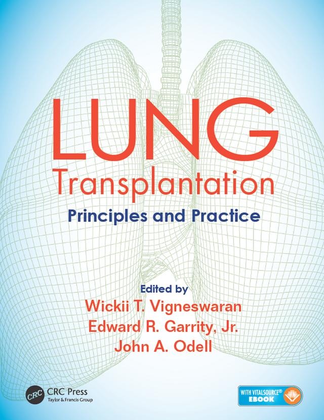 Lung Transplantation by Edward Garrity, John Odell, Wickii Vigneswaran