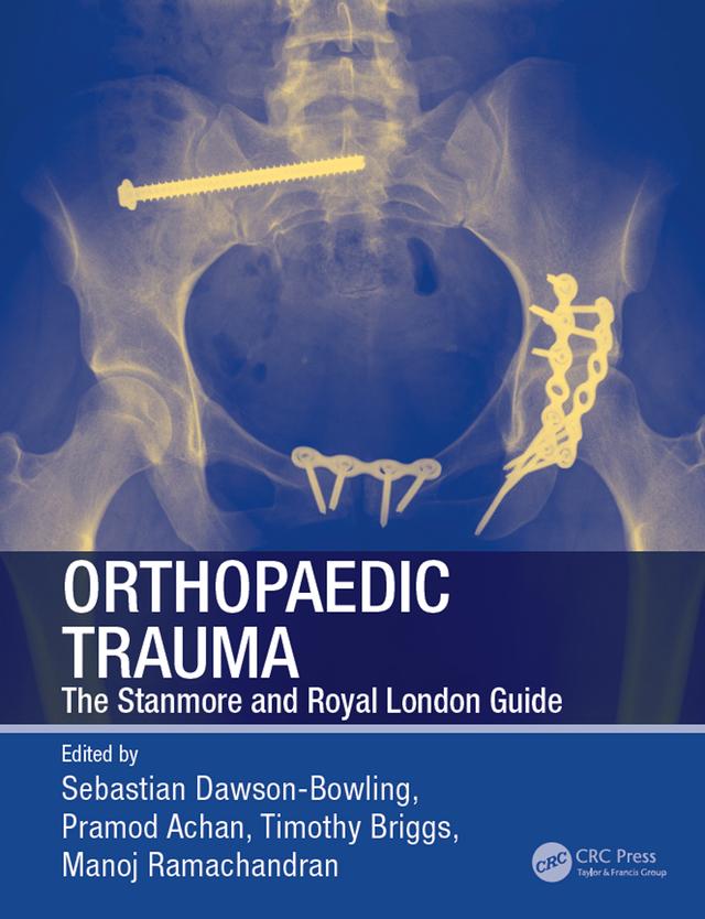Orthopaedic Trauma by Manoj Ramachandran, Pramod Achan, Sebastian Dawson-Bowling, Timothy Briggs
