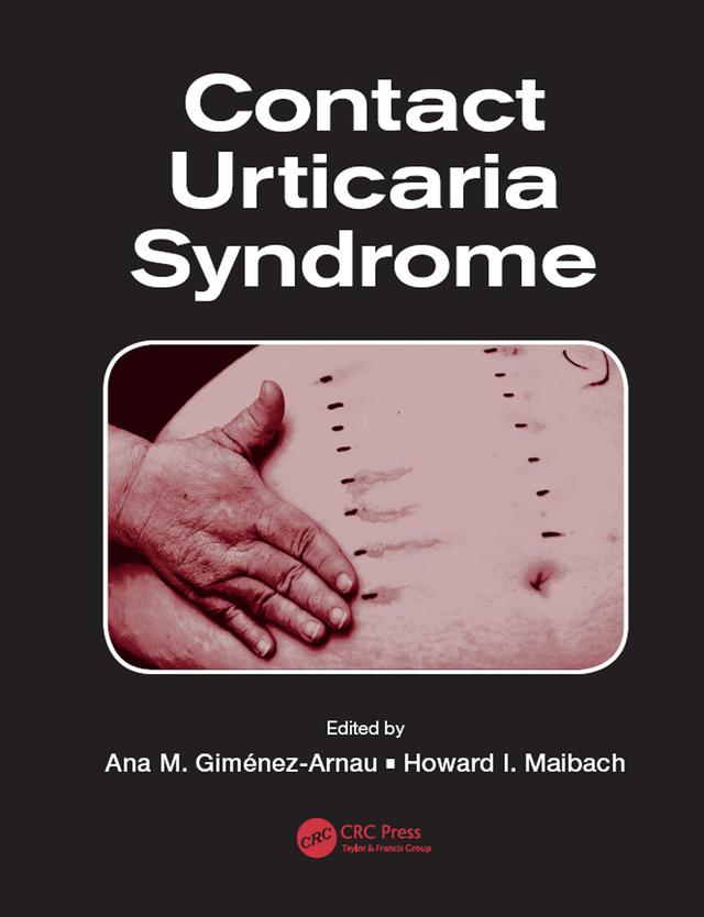 Contact Urticaria Syndrome by Ana M. Gimenez-Arnau, Howard I. Maibach