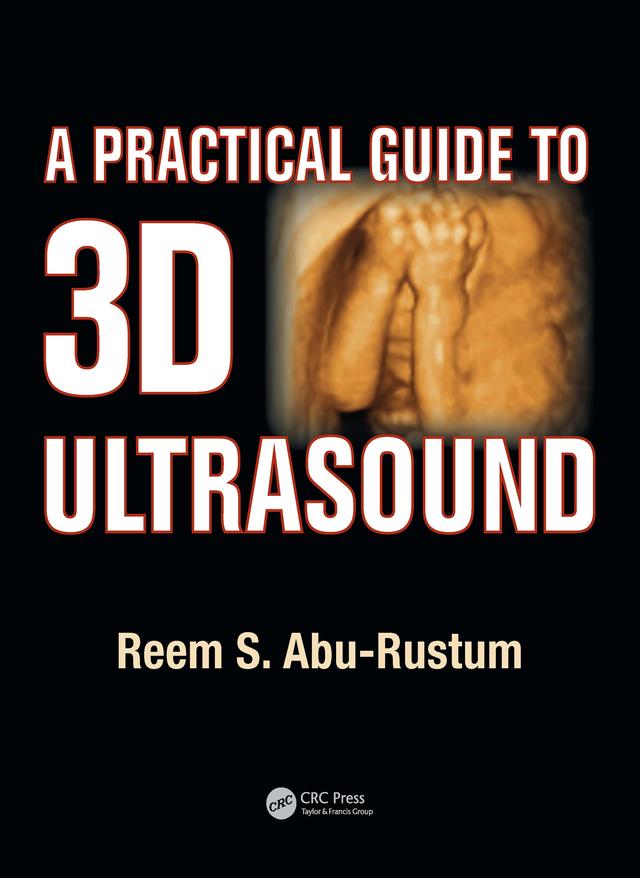 A Practical Guide to 3D Ultrasound by Reem S. Abu-Rustum