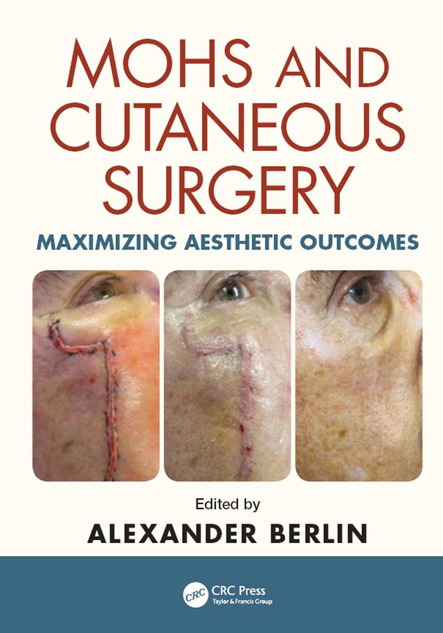 Mohs and Cutaneous Surgery by Alexander Berlin