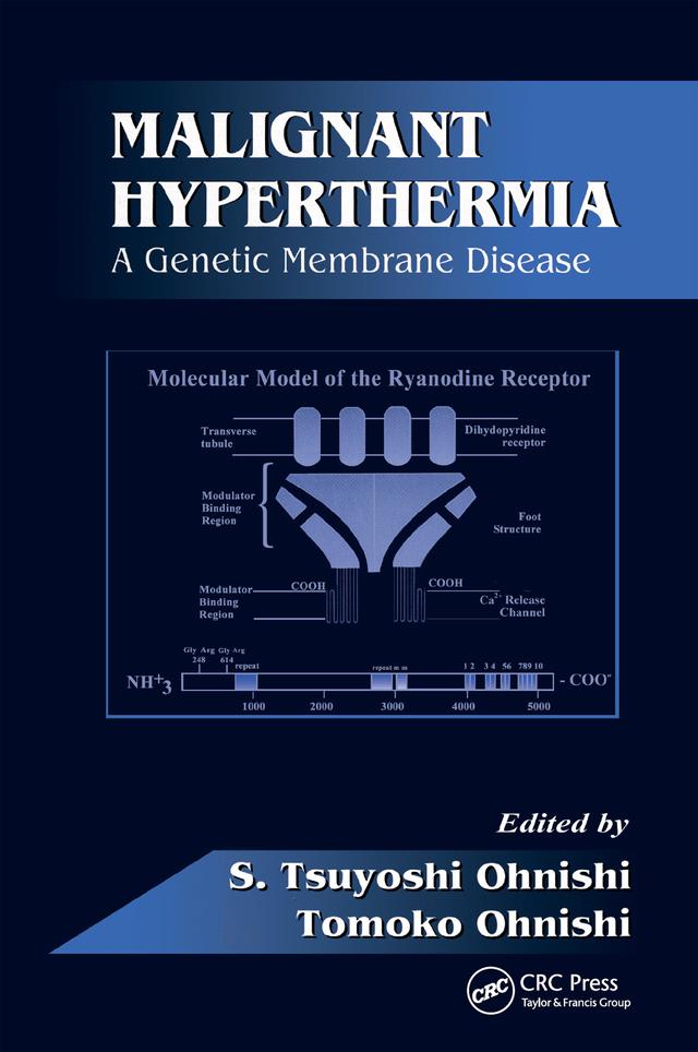 Malignant Hyperthermia by S. Tsuyoshi Ohnishi, Tomoko Ohnishi