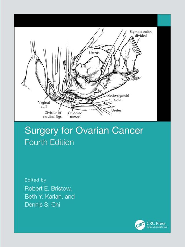 Surgery for Ovarian Cancer by Beth Karlan, Dennis Chi, Robert Bristow