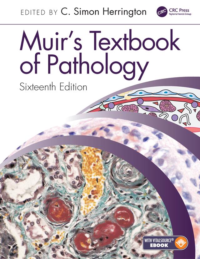 Muir's Textbook of Pathology by C Simon Herrington