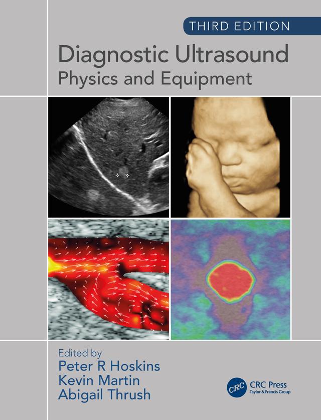 Diagnostic Ultrasound, Third Edition by Abigail Thrush, Kevin Martin, Peter Hoskins