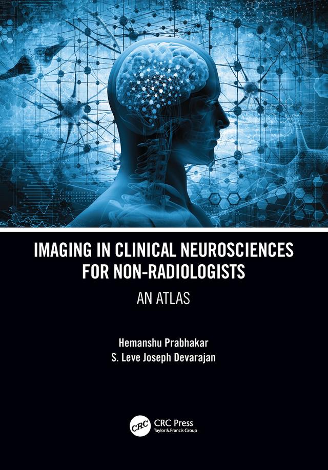 Imaging in Clinical Neurosciences for Non-radiologists by Hemanshu Prabhakar, S. Leve Joseph Devarajan