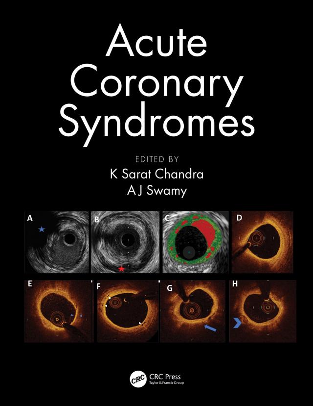 Acute Coronary Syndromes by AJ Swamy, K Sarat Chandra