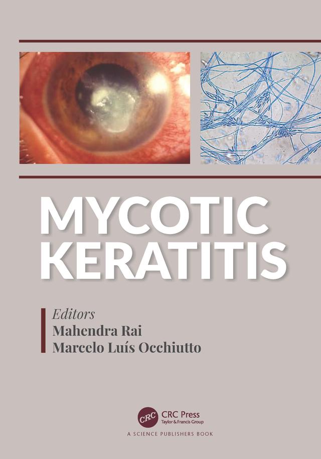 Mycotic Keratitis by Mahendra Rai, Marcelo Luis Occhiutto