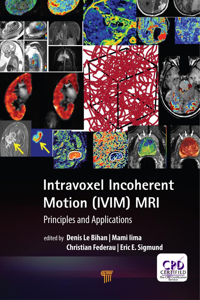 Intravoxel Incoherent Motion (IVIM) MRI by Christian Federau, Denis Le Bihan, Eric E. Sigmund, Mami Iima