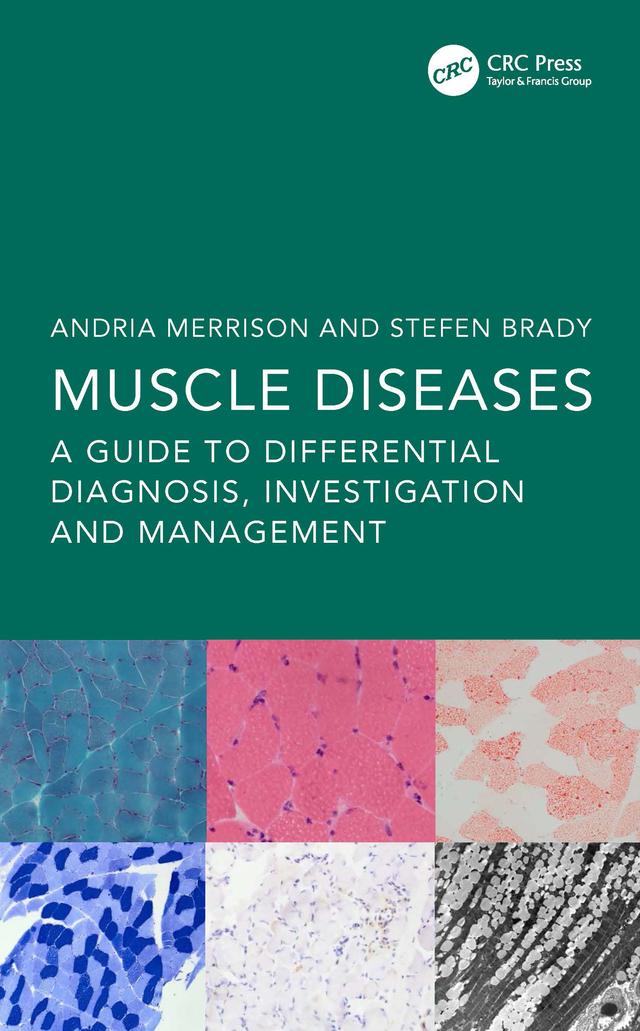 Muscle Diseases by Andria Merrison, Stefen Brady