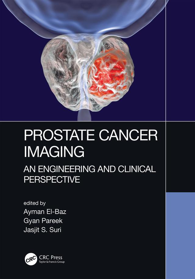 Prostate Cancer Imaging by Ayman El-Baz, Gyan Pareek, Jasjit S. Suri