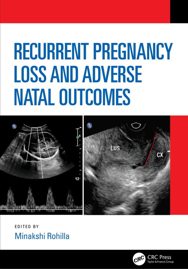 Recurrent Pregnancy Loss and Adverse Natal Outcomes by Minakshi Rohilla