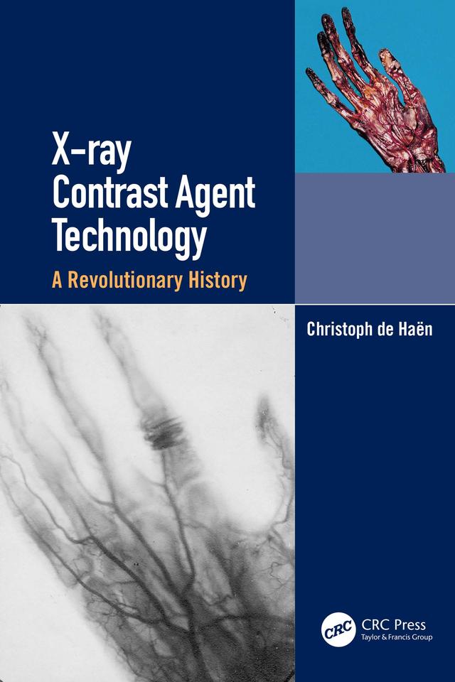 X-ray Contrast Agent Technology by Christoph de Haen