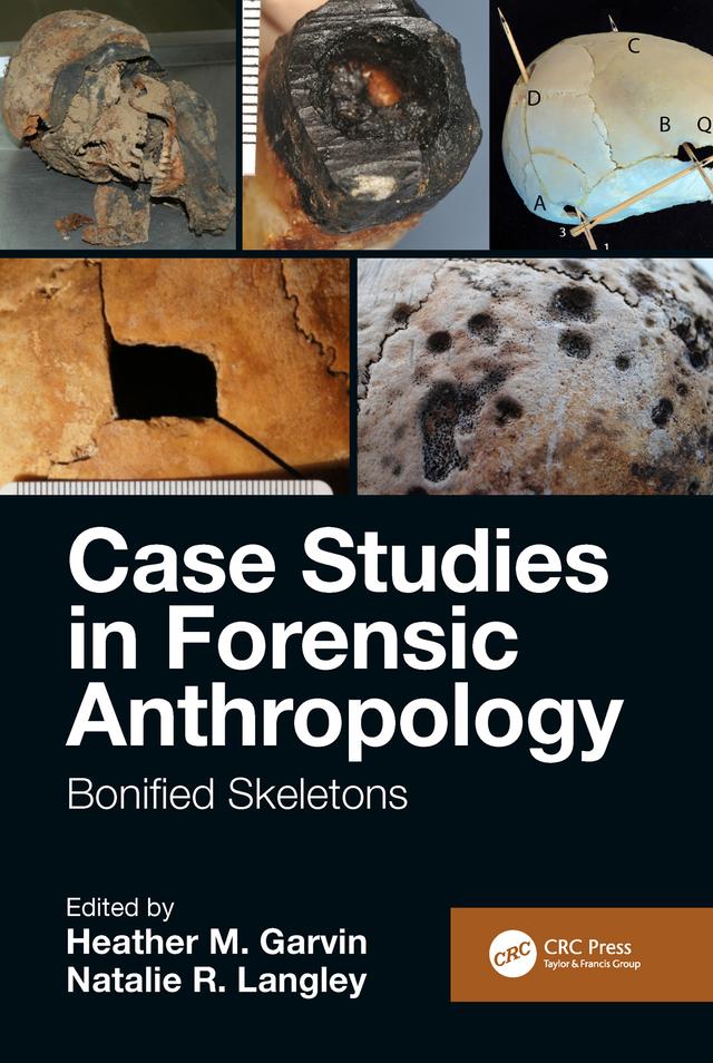 Case Studies in Forensic Anthropology by Heather M. Garvin, Natalie R. Langley