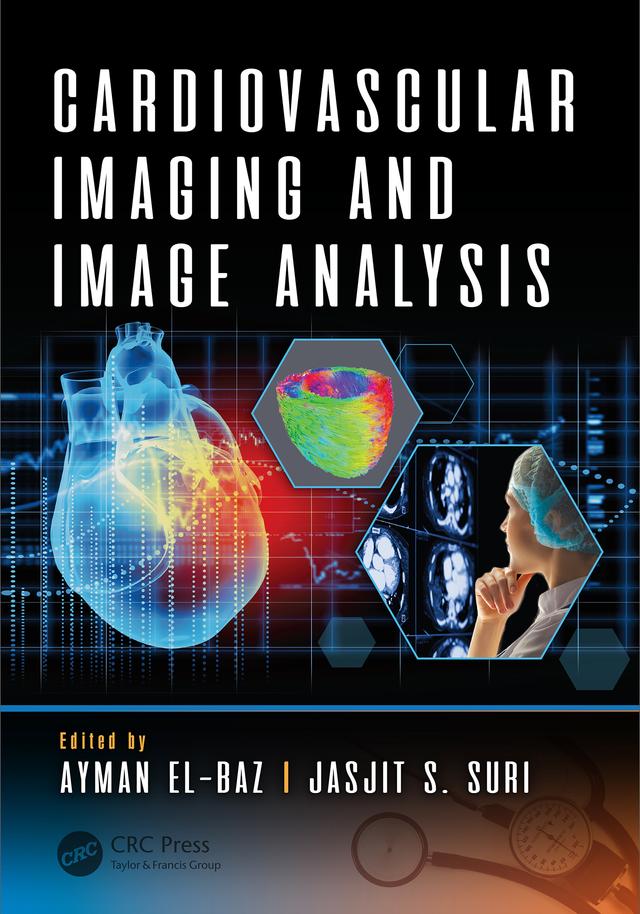 Cardiovascular Imaging and Image Analysis by Ayman El-Baz, Jasjit S. Suri