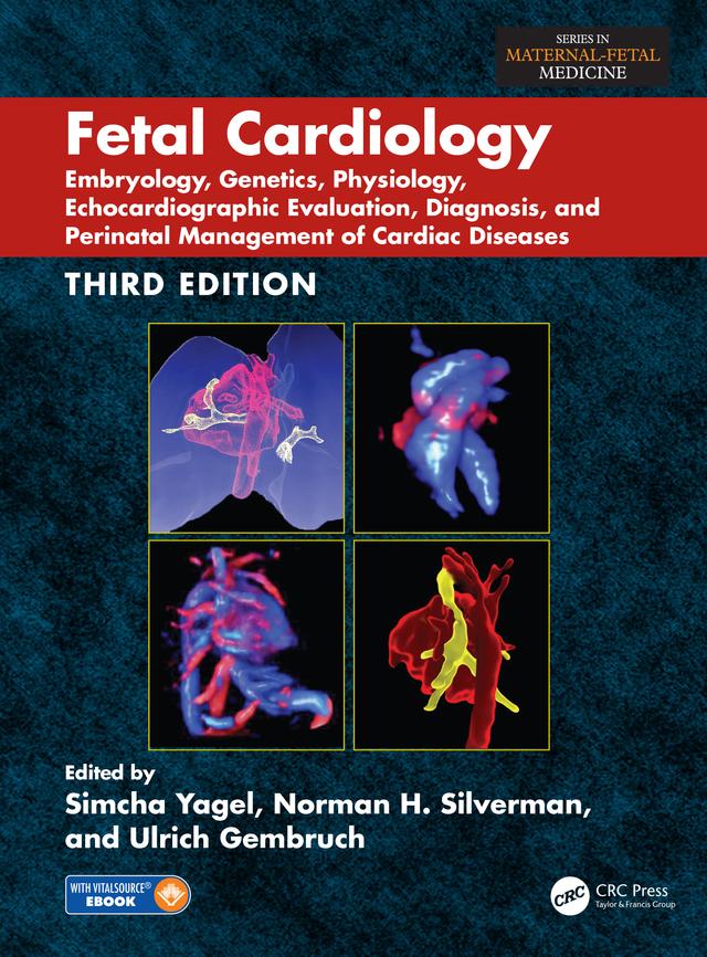 Fetal Cardiology by Norman H. Silverman, Simcha Yagel, Ulrich Gembruch