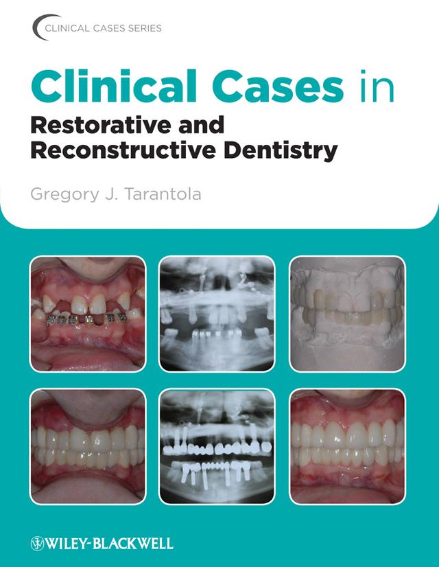 Clinical Cases in Restorative and Reconstructive Dentistry by Gregory J. Tarantola, DDS