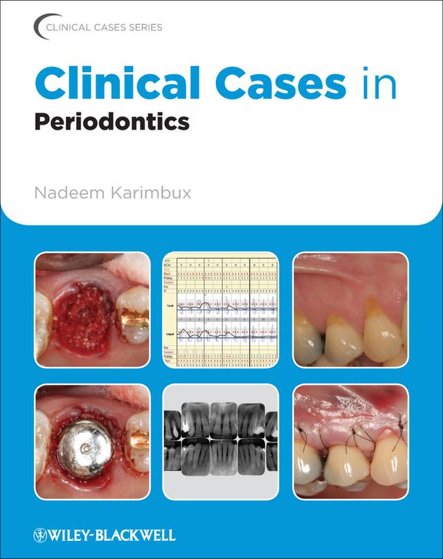 Clinical Cases in Periodontics by Nadeem Karimbux