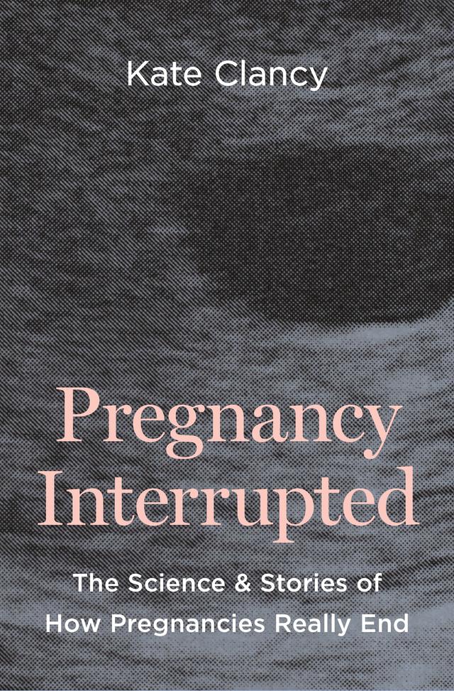 Pregnancy Interrupted by Kate Clancy