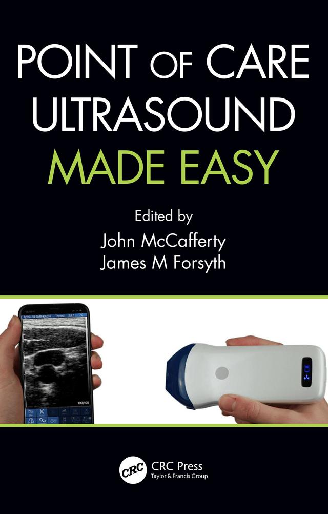 Point of Care Ultrasound Made Easy by James Forsyth, John McCafferty