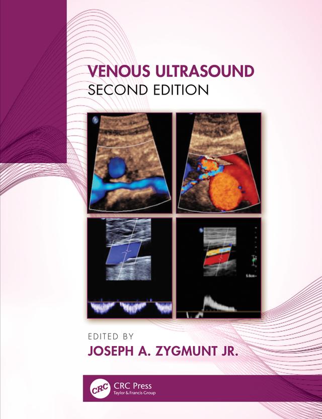 Venous Ultrasound by Joseph A. Zygmunt Jr.