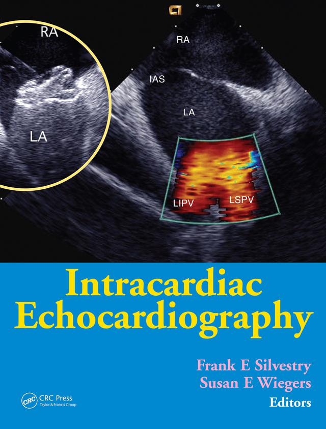 Intracardiac Echocardiography by Frank E. Silvestry, Susan E. Wiegers
